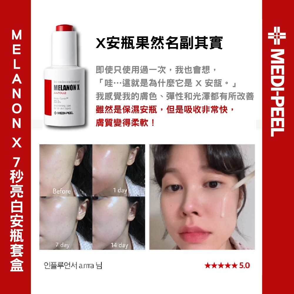 张雨绮闪婚 你敢爱就结婚吗