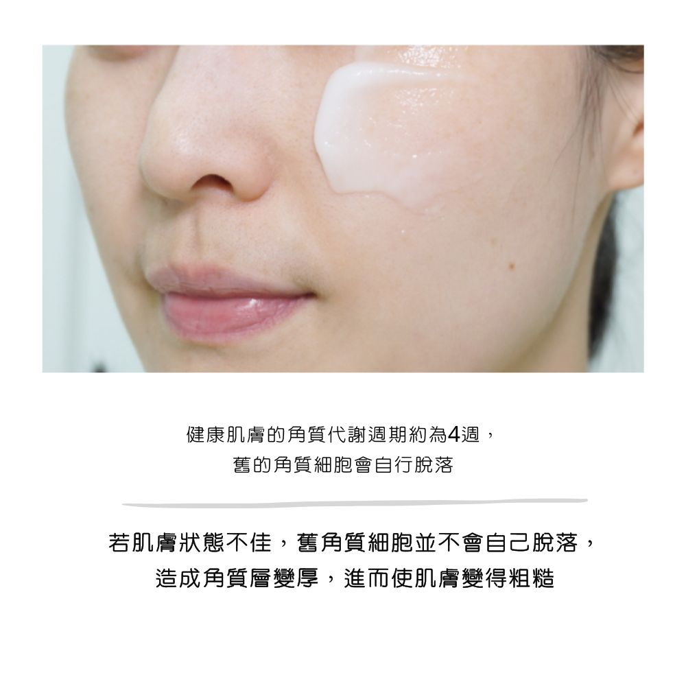 精致小V脸上镜秘诀，你还在等什么？